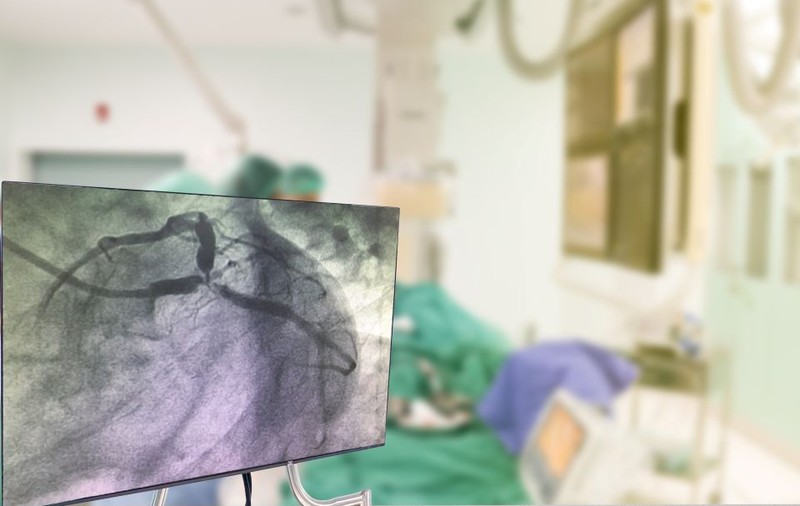 Ce afecțiuni poate diagnostica procedura de angiografie