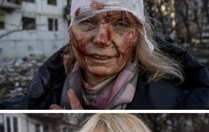 „Visez să readuc zâmbetul copiilor în orașul meu”. Olena Kurilo, educatoarea devenită imaginea suferinței din Ucraina după ce a fost rănită în bombardamente, s-a întors acasă