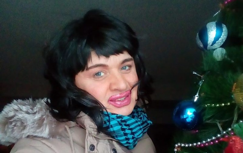 Prima imagine cu sânii lui Cristi din Banat, după tratamentul hormonal. "Mă simt foarte slăbit”