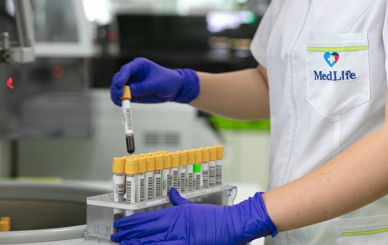 De ce e important să-ți faci anual analize și cum te pot ajuta în acest sens abonamentele medicale private