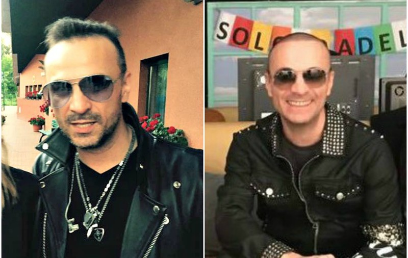 EXCLUSIV/Secretul lui Cristi Enache. Solistul grupului Direcția 5 s-a tuns chilug pentru a-și  implanta păr