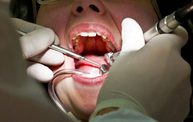 Oamenii merg la dentist de 6.500 de ani! S-a descoperit DOVADA CLARĂ