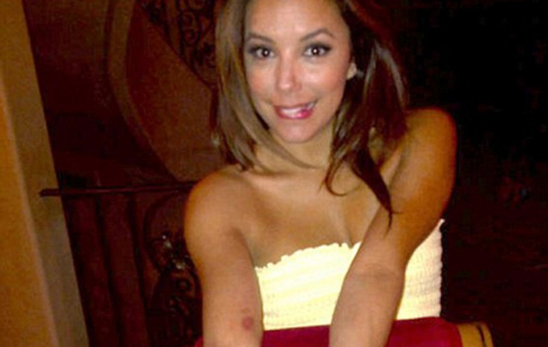 Ce vânătai are Eva Longoria! Vezi motivul!