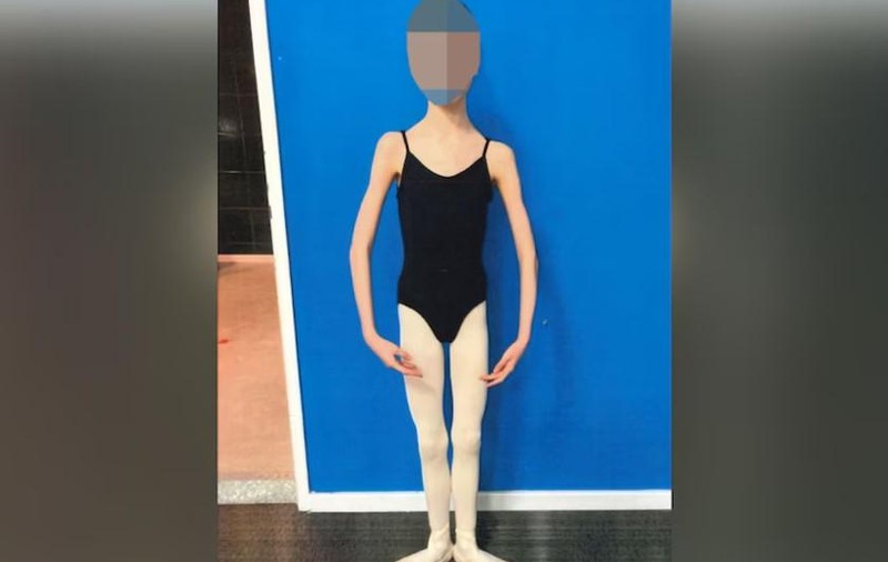 Doi părinți și-au înfometat fiica pentru că doreau să rămână mică. Fata de 17 ani ajunsese să cântărească 27,3 kilograme