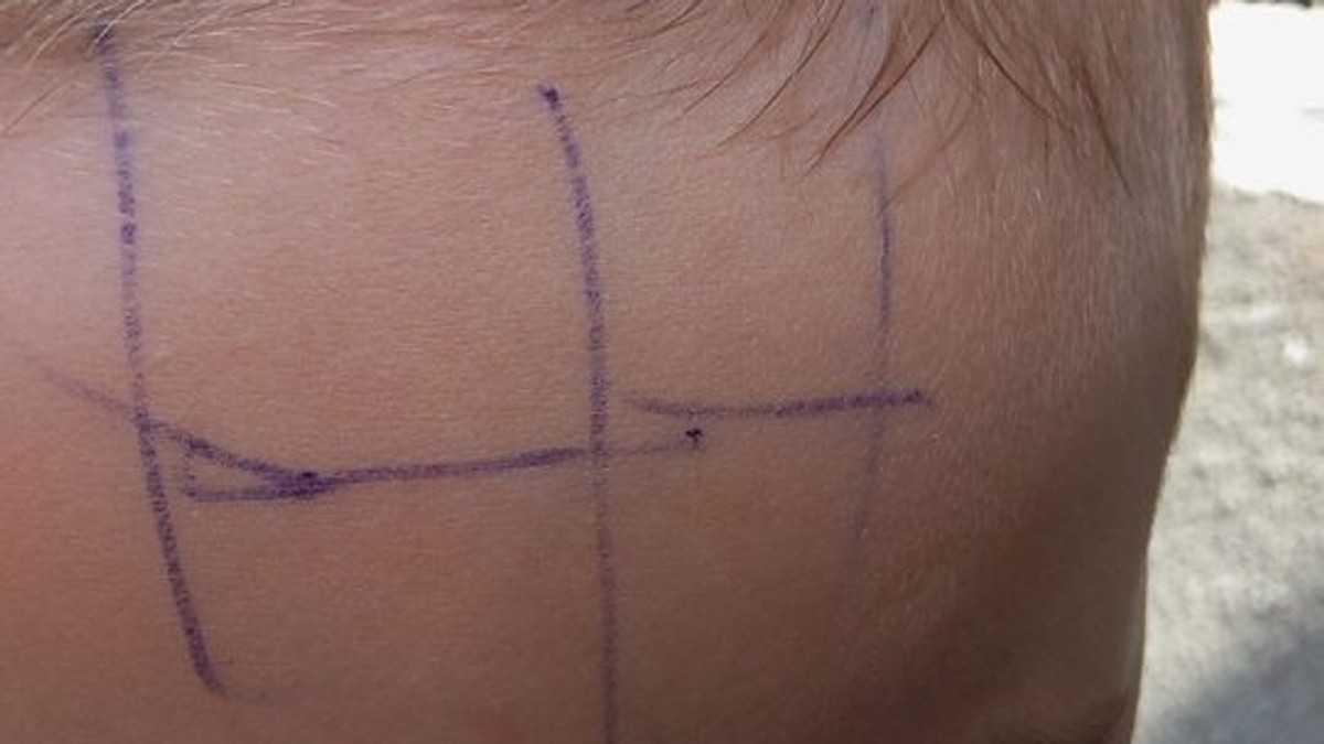 O educatoare din Gorj a scris cu pixul de fruntea unui copil de patru ani