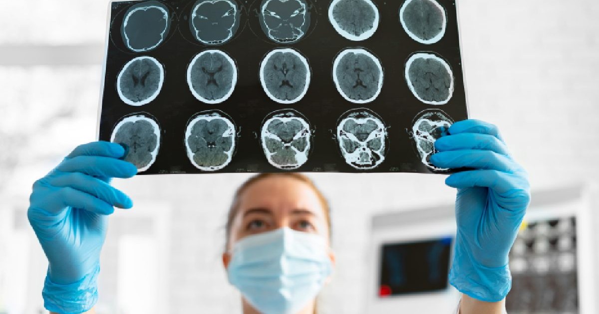 O femeie cu masca si cu manusi,cadru medical priveste la o radiografie cu creiere. Traumatisme craniene
