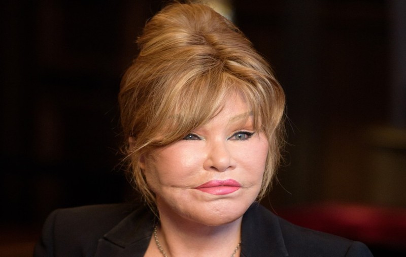 Jocelyn „Catwoman” Wildenstein a murit. Cea mai cunoscută victimă a chirurgiei plastice avea 84 de ani