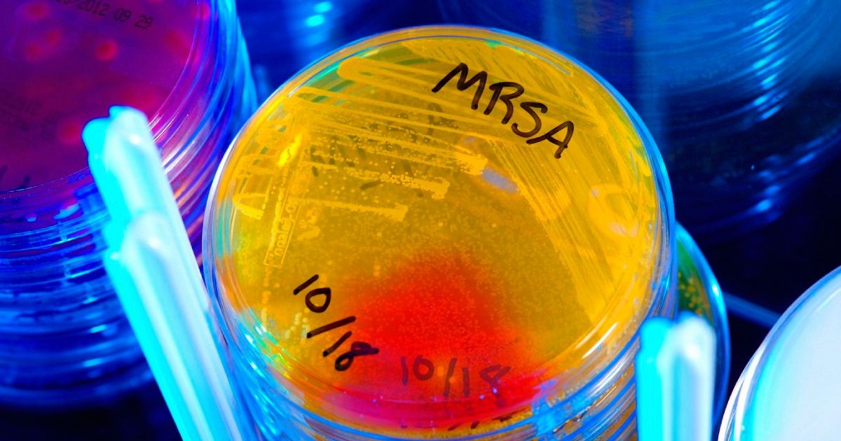 Cultura de bacterii MRSA, rezistente la antibiotice, in laborator,