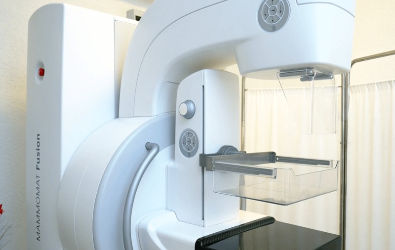 Medicii avertizează: Cancerul de sân este descoperit prea târziu în România. Mamografia rămâne esențială