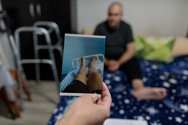 Stelu Stoica, 51 de ani, și-a pierdut piciorul după ce s-a îmbolnăvit de Covid