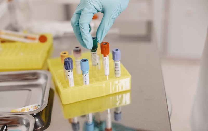 Top laboratoare de analize medicale din România: cum alegi, după criterii verificabile