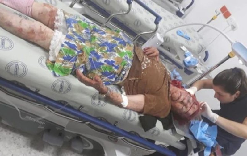 O bătrână, jefuită și bătută crunt. I-a luat până și proteza dentară