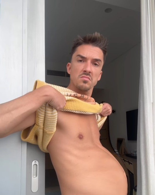 Reacții după ce Emil Rengle a folosit un filtru care imită sarcina. Fanii nu s-au abținut: „Chiar o să creadă lumea că ești gravid”