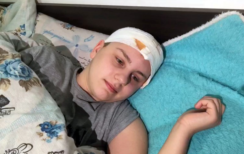 VIDEO&FOTO/ Primele mărturii ale Alinei, fata care a căzut prin geamul unui autobuz din Ploiești. Un accident stupid o costă un an din viață