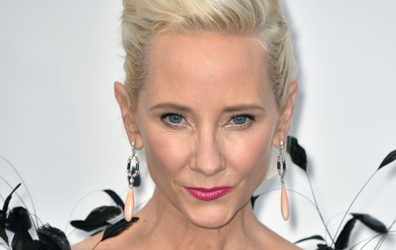 Actrița Anne Heche are arsuri grave și o așteaptă o recuperare lungă, după accidentul de maşină
