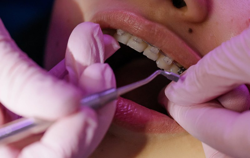 Gentle Dentist explică abordările moderne în ortodonția pentru toate vârstele