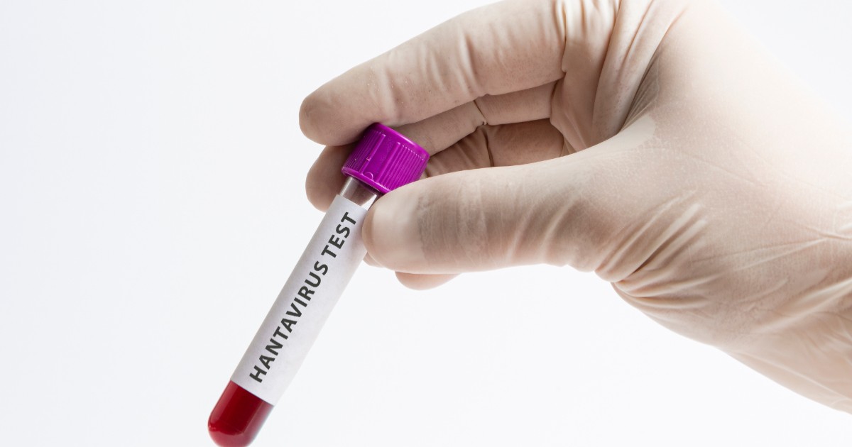 O femeie care poartă mănuși medicale și ține în mână o epubretă pe care scrie hantavirus test