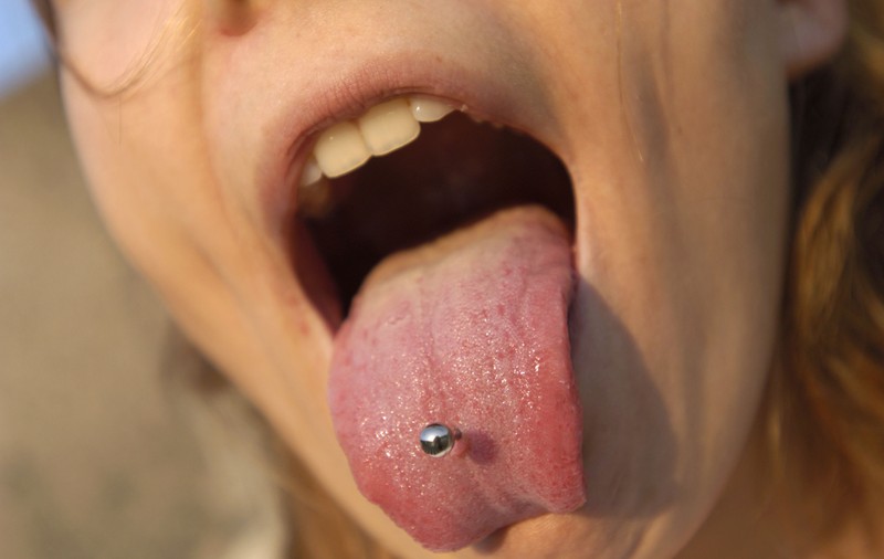 Piercingul: o problemă în plus?