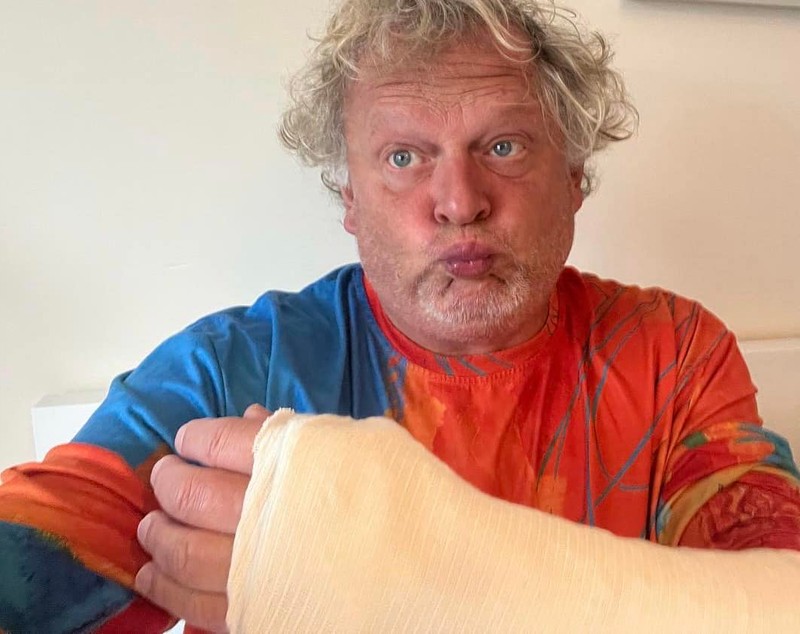 Leonard Miron a ajuns la spital cu mâna ruptă și o coastă fisurată: „M-am împiedicat și am alunecat vreo 4-5 trepte”