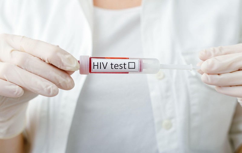 Pandemia COVID a agravat situaţia HIV în România. Rata de testare s-a prăbușit, numărul infectărilor a crescut