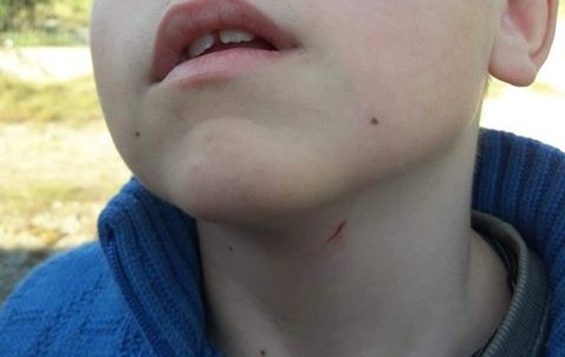 Un învățător din Botoșani a strâns de gât un elev de clasa I. Dascălul ar fi bătut și o fetiță