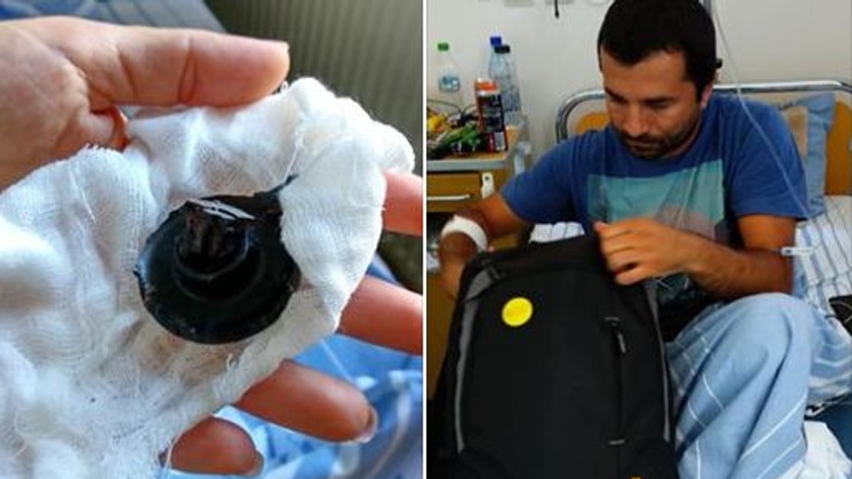 Bărbatul cu gaura în picior de la o grenadă susține că a luat o bacterie ucigașă din spital. Doru Oprea, contaminat la Municipal