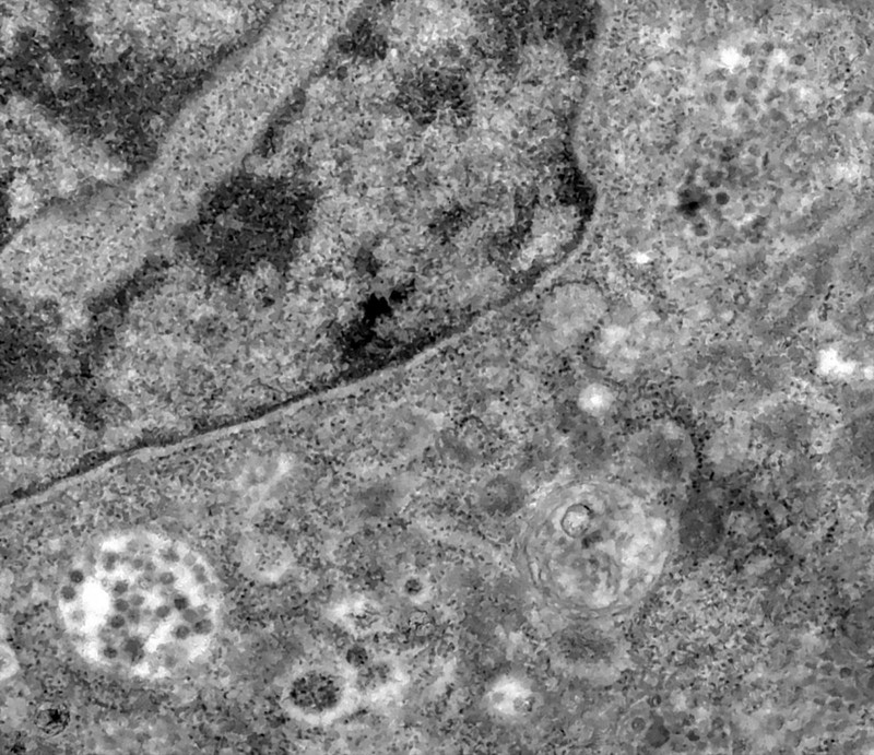 Celula (cercul alb din colțul din stânga) este deja infectată, iar particulele virale au început înmulțirea FOTO: EPA