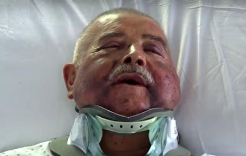 O nouă mărturie a medicului italian torturat de o bandă de români: "Tot ce vreau este să uit"
