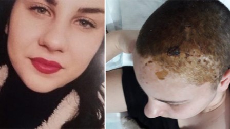 Tânăra care a căzut în cap dintr-un autobuz va fi audiată săptămâna viitoare. Poliţiştii au decis audierea după articolul din Libertatea
