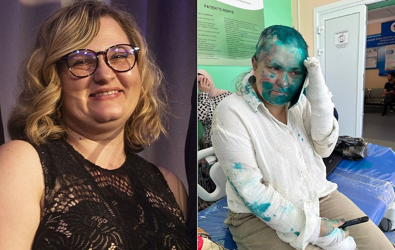 Cu degete rupte, bătută, rasă în cap și stropită cu vopsea. O jurnalistă Novaia Gazeta, atacată în Cecenia. Ce caz urmărea