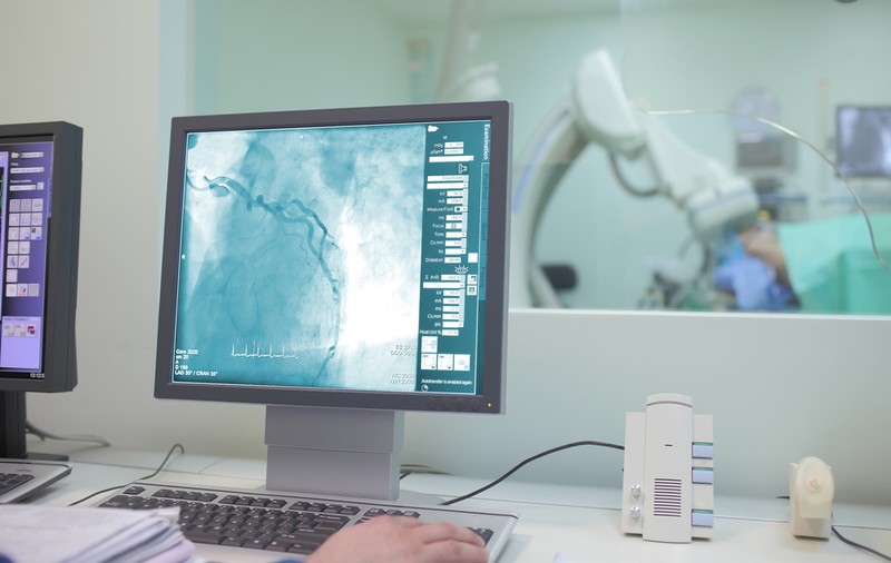 Coronarografia vs Tomografia computerizată: o analiză comparativă