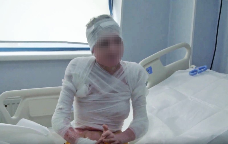 Strigăt de ajutor pentru fata din Mehedinți, incendiată de un criminal. Supraviețuitor Colectiv: “A trecut prin toate formele imaginabile de abuz”