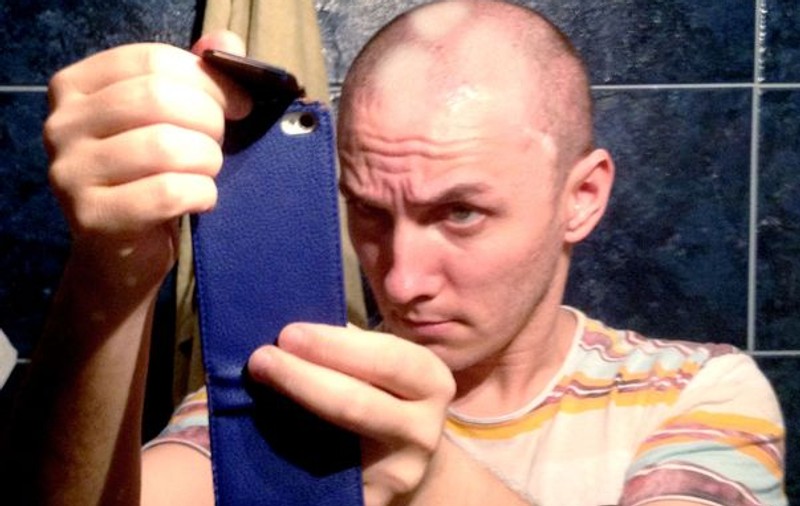 EXCLUSIV | Trăistariu, ÎNGROZIT! A rămas fără păr pe alocuri după ce a adormit cu soluţia pe cap şi şi-a smuls părul cu totul
