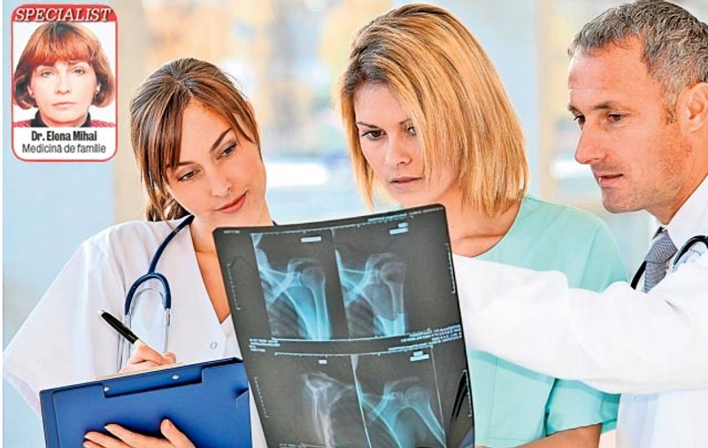 Alarmă! Osteoporoza apare tot mai devreme!