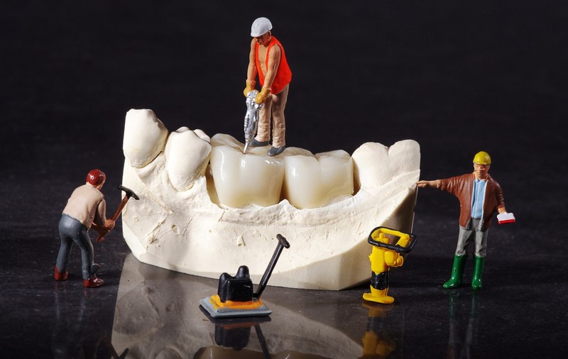 Implant sau punte dentară? Care sunt diferențele și ce este indicat să alegi!