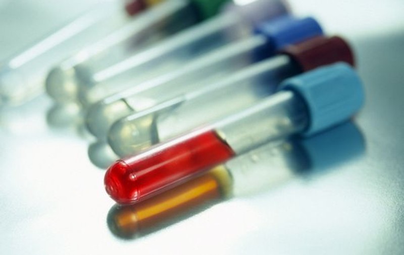 Descoperire istorică: un virus distruge cancerul