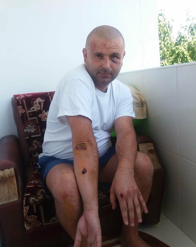 Un polițist din Piatra Neamț a fost bătut și lăsat fără încărcător. A primit pumni în cap pentru ca pistolul să nu ajungă la agresori