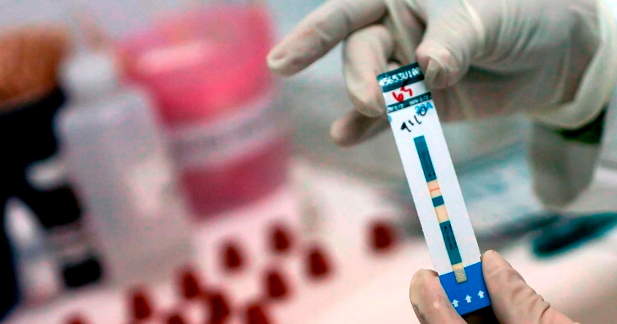 Virusul HIV, eliminat cu ajutorul transplantului de celule stem