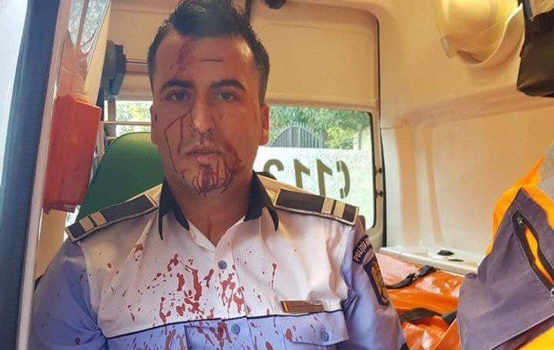 UPDATE. Polițist din Craiova, bătut cu telefonul mobil de un șofer pe care a încercat să-l rețină. Imagini șocante cu omul legii după agresiune