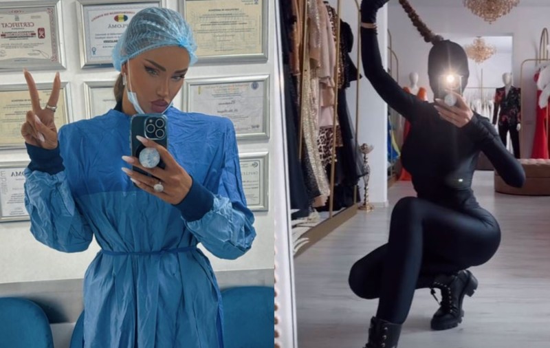Bianca Drăgușanu a fost fotografiată fără cagulă. Are fața umflată și vânătă, după operația estetică de 7 ore și 11.000 de euro