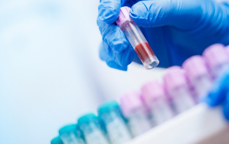 Depistarea cancerului cu un simplu test de sânge: o soluție promițătoare?