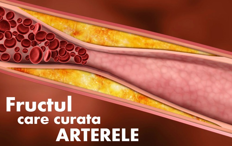 Fructul care îți curăță arterele