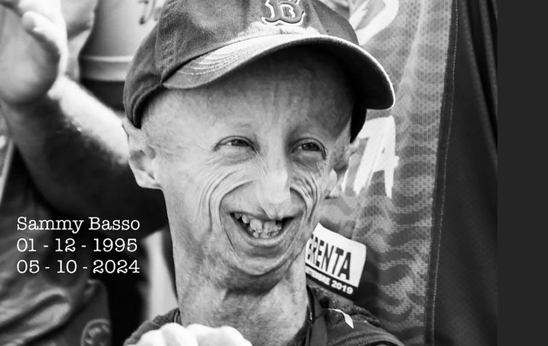Sammy Basso, cel mai longeviv supraviețuitor diagnosticat cu progeria, o boală genetică rară, a murit la 28 de ani