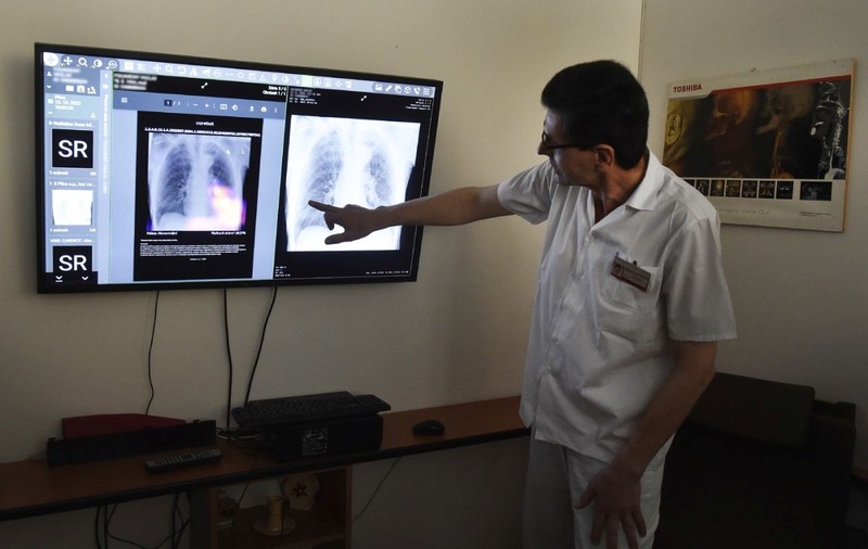 „Plămânul pe cip” care respiră ca unul real: descoperire ce promite să schimbe cercetarea medicală