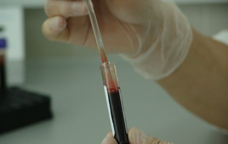 Sângele cazurilor vindecate de coronavirus ar putea fi folosit ca tratament pentru pacienții bolnavi de COVID-19