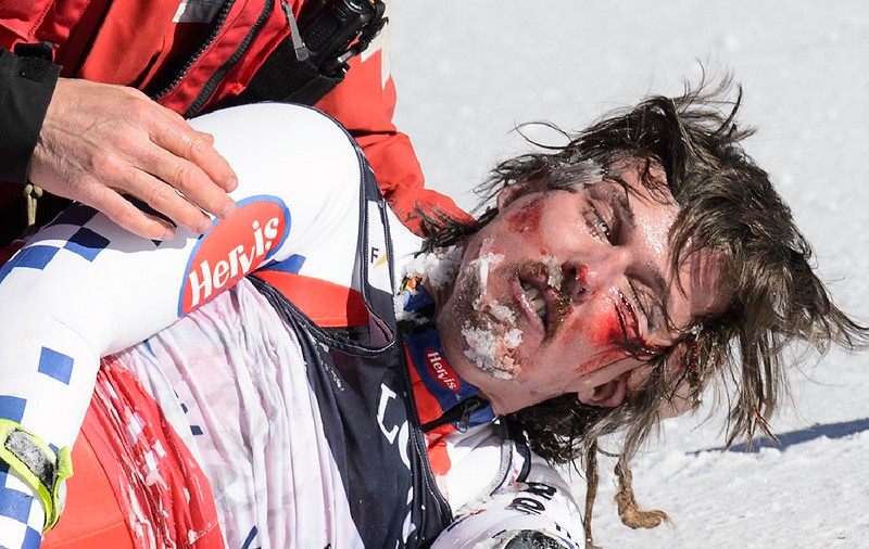 Schiorul Ondrej Bank, accidentare care l-a desfigurat / FOTO