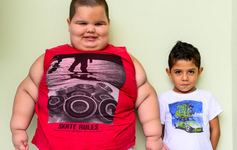 La cinci ani cântărește 76 de kilograme și poate muri sufocat în orice moment! GALERIE FOTO