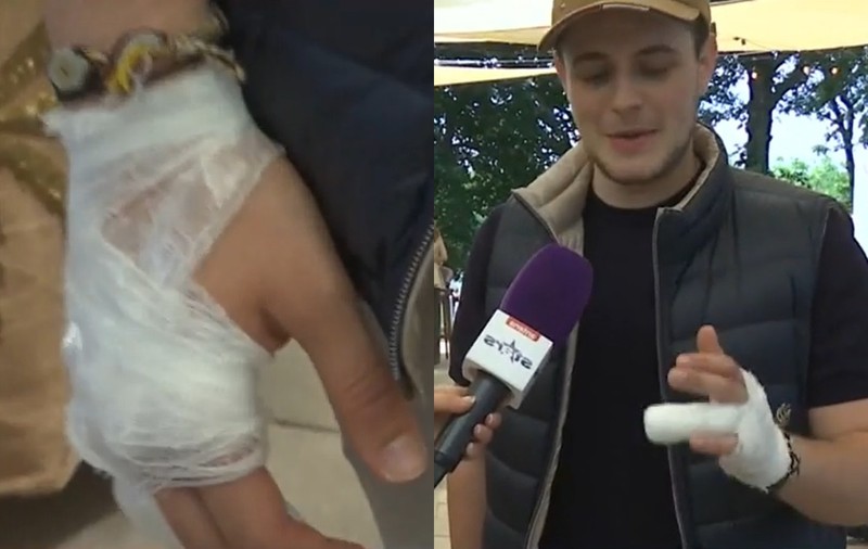 Aris Eram, cu mâna bandajată la un eveniment. Ce a pățit băiatul Andreei Esca: „Am ajuns direct la Urgențe! M-au cusut”