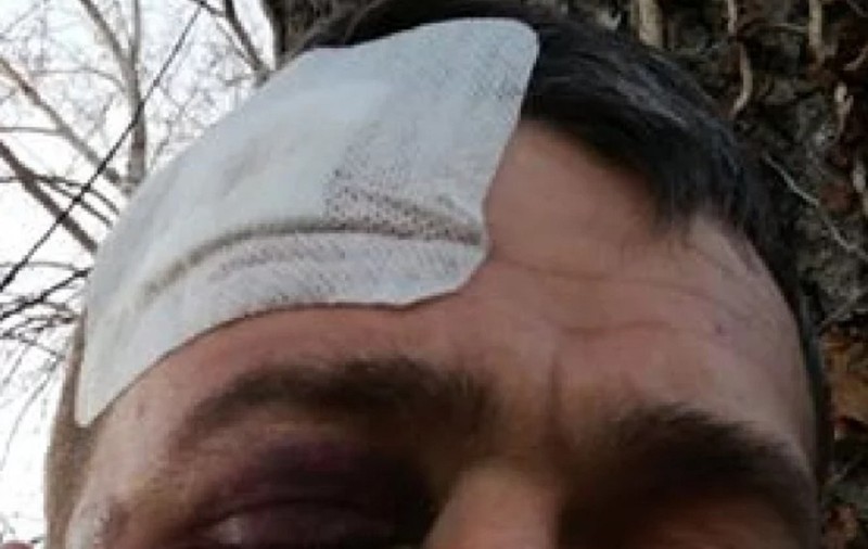 Un român care muncește în Italia a fost dat afară din casă, bătut crunt și tâlhărit. "Am nevoie de ajutor"