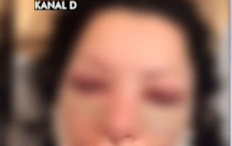 BRIGITTE SFĂT, apariţie ŞOC, după operaţia estetică! Ilie Năstase: "Am dormit cu spatele la ea, de frică"
